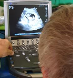 Echographie au dispensaire