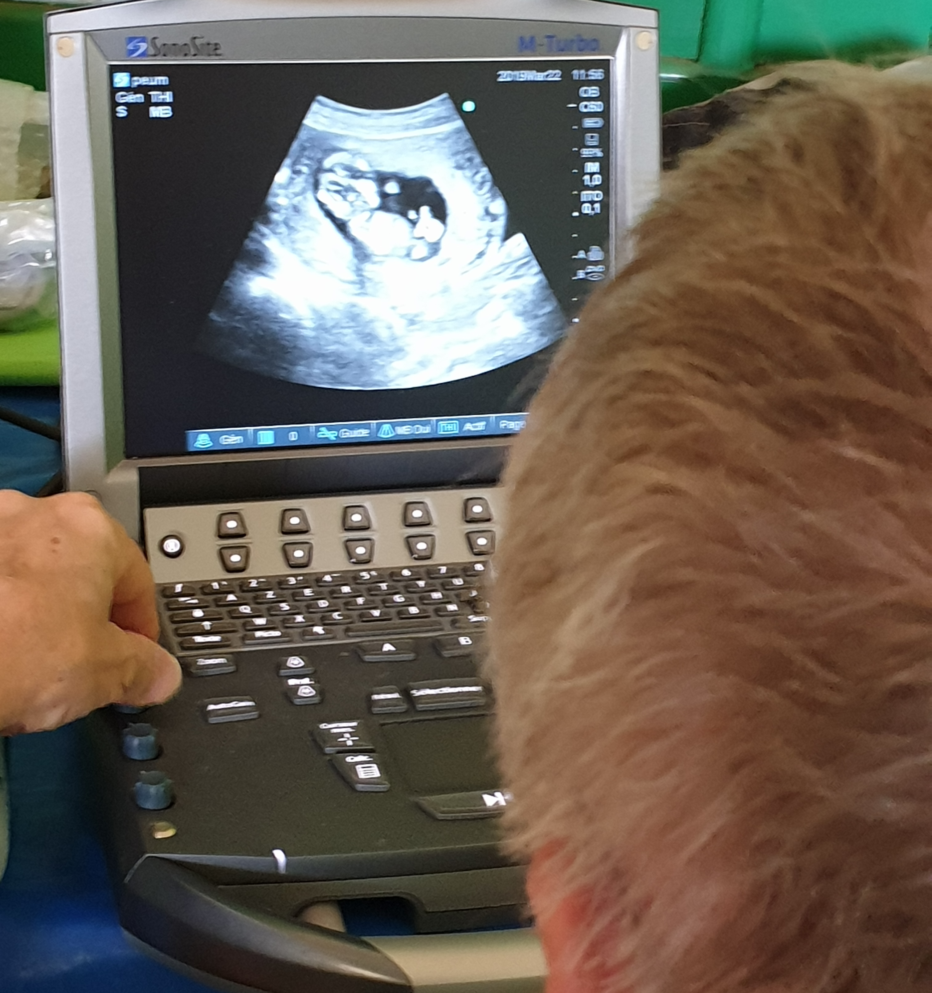 Echographie au dispensaire